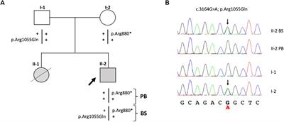 Phenotype reversion as “natural gene therapy” in Fanconi anemia by a gene conversion event